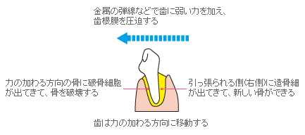 矯正の仕組み