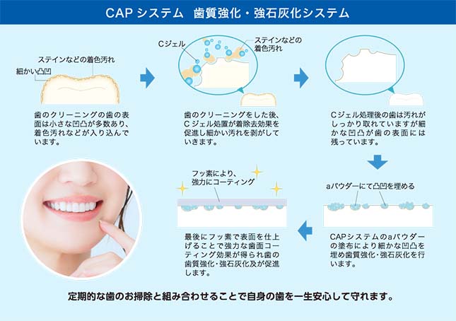 CAPシステム 歯質強化・共石灰化システム
