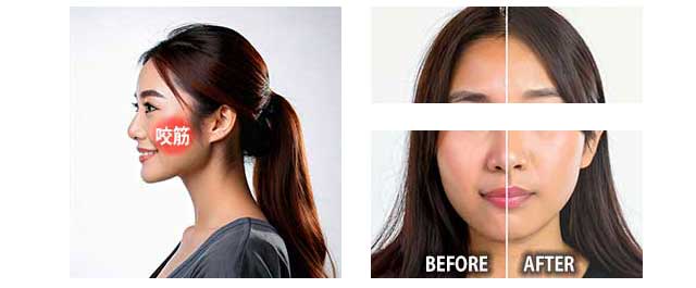 BEFORE / AFTER (画像説明)